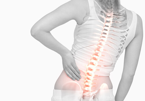 महिलाओं में कमर दर्द - Back Pain in women