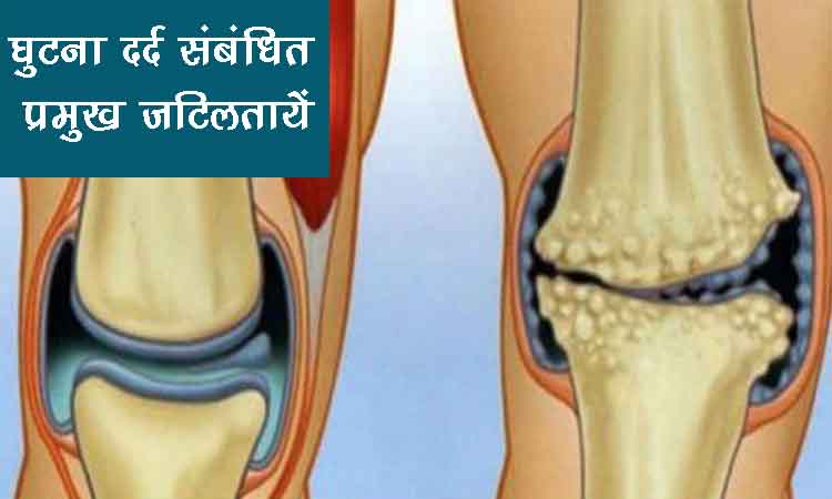 घुटना दर्द संबंधित प्रमुख जटिलतायें