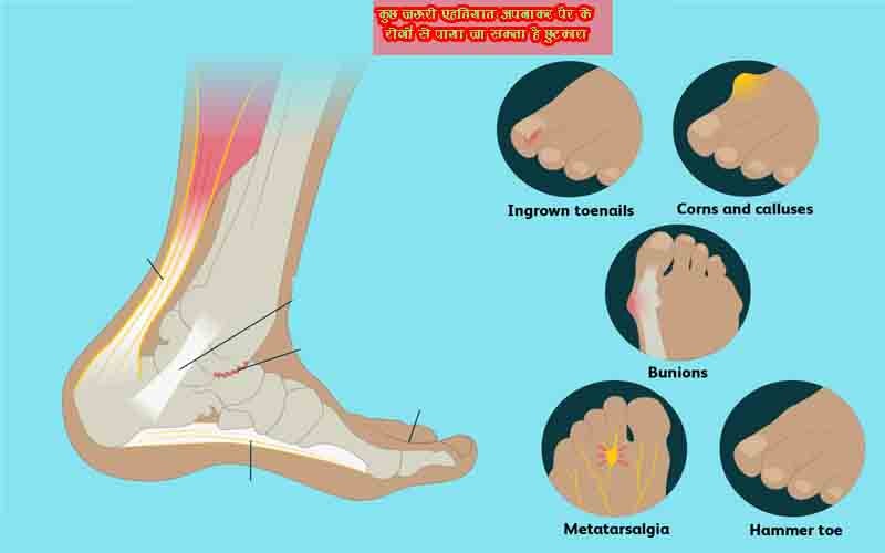 कुछ जरूरी एहतियात अपनाकर पैर के रोगों से पाया जा सकता है छुटकारा